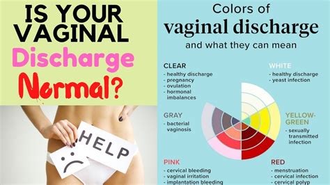 Vaginal Discharge Types Treatment White Vaginal Discharge Explained Sexiezpicz Web Porn