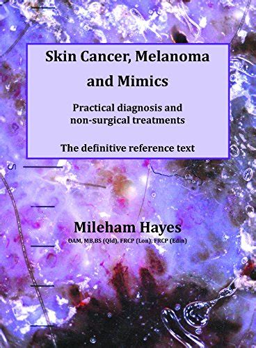 Skin Cancer Melanoma And Mimics Practical Diagnosis And Non Surgical