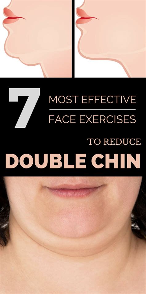 7 Most Effective Face Exercises To Reduce Double Chin