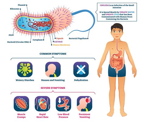 Pathogen Of The Month Vibrio Cholerae The Causative Agent Of Cholera