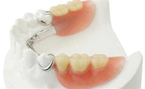 Denture Prosthesis Implantcenter Dentistry Uk
