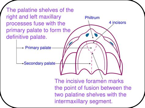 Ppt Development Of The Face And Palate Powerpoint Presentation Free