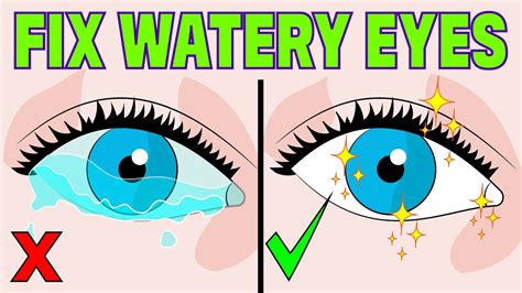 How To Stop Watery Eyes At Home In 3 Minutes Youtube