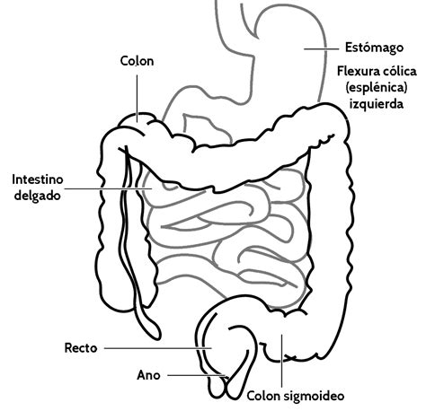 Flexura Esplênica Do Cólon