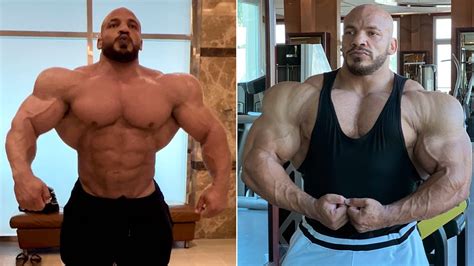 Synthol Before After