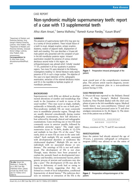 Pdf Non Syndromic Multiple Supernumerary Teeth Report Of A Case With
