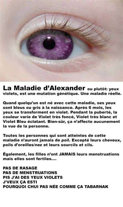 Maladie Dalexander Violet Eyes Alexandria Genesis Genetic Mutation