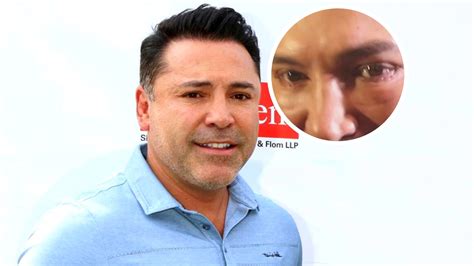 Óscar De La Hoya Reaparece Con ‘arregluito En La Cara Tras Acusaciones De Agresión Sexual