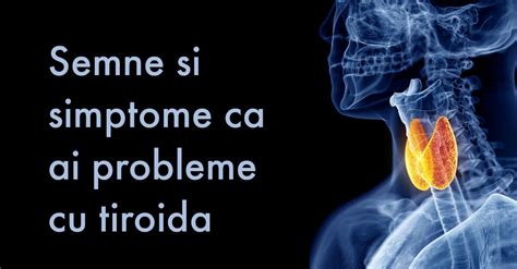 Ai Glanda Semne Si Simptome Ca Ai Probleme Cu Tiroida