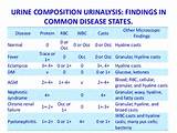 Images of Urinalysis Normal Ranges
