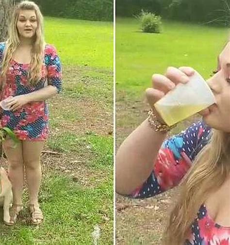Woman Claims Drinking Her Dogs Urine Helps Clear Bad Acne Nz Herald