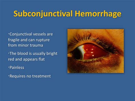 Ppt Facial Trauma Powerpoint Presentation Free Download Id2392727