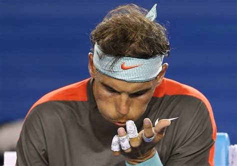 Rafael Nadal Keeps Winning Despite A Nasty Blister On His Left Hand