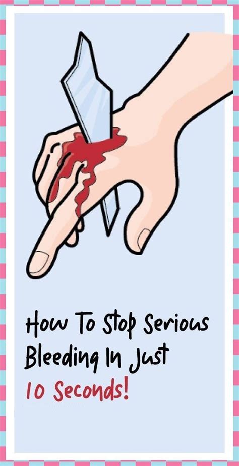 How To Stop Bleeding In 10 Seconds In 2020 Common Spices Health And
