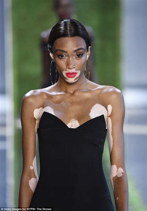 Winnie Harlow Announced As Victorias Secret Model Daily Mail Online