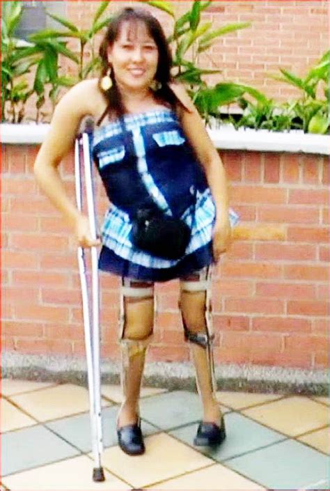 Pin By Michael Kramer On Disabled Ladies Braces Girls Leg Braces Women