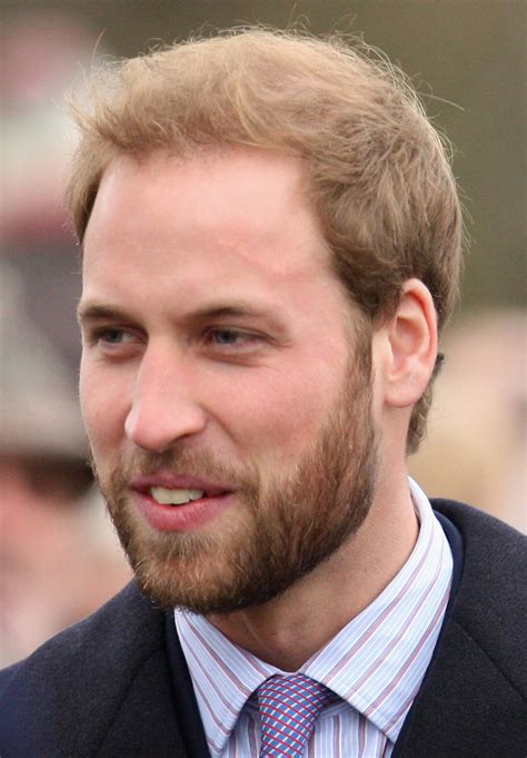 Prince William Has A Huge Scar On His Forehead Iheart