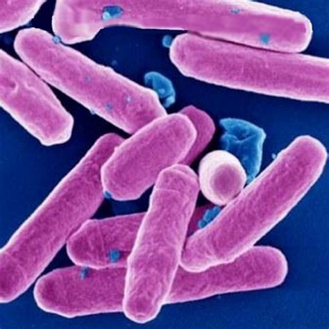 Santé Quelles Différences Entre Microbe Virus Et Bactérie