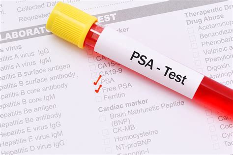 Elevated Psa In Men Prostate Cancer Test Urology Austin