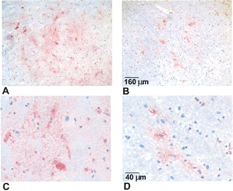 Direct Immunohistochemistry On Frozen Sections Of The Post Mortem Brain