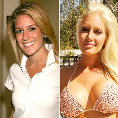 Heidi Montag Before And After Nose Job