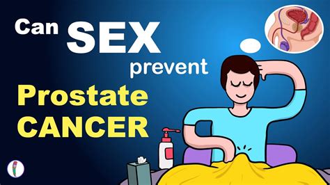 Can Frequent Sex Prevent Prostate Cancer Ways To Prevent Prostate Cancer Youtube