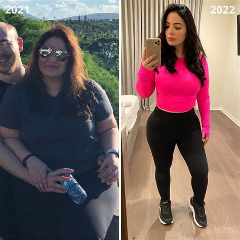 Gastric Sleeve Before And After 2022