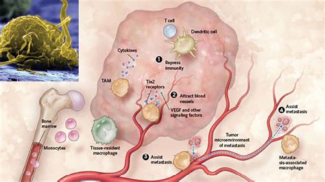 Most Tumors Contain Macrophages That Aid Tumor Growth