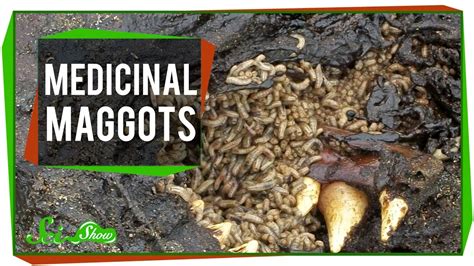 Marvelous Medicinal Maggots Youtube
