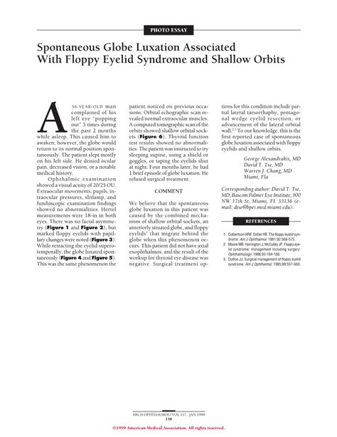 Spontaneous Globe Luxation Associated With Floppy Eyelid Syndrome And