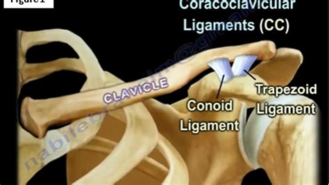 Causes Of Clavicle Fracture Surgery For Clavicle Fracture Broken