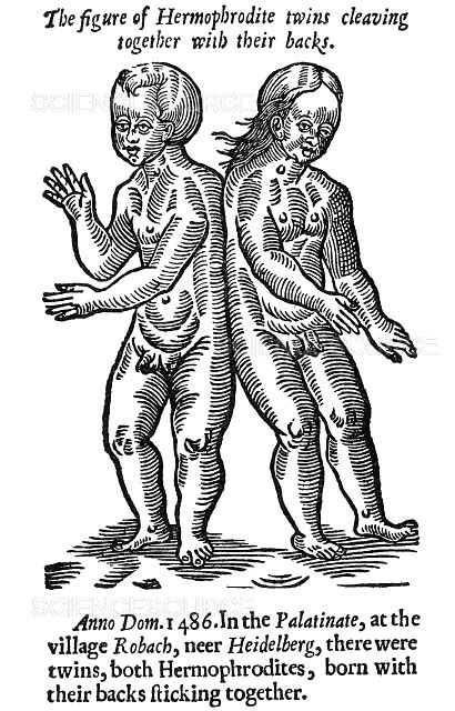 Hermaphrodite Twins 1649 Stock Image Science Source Images