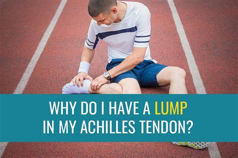 Why Do I Have A Lump In My Achilles Tendon