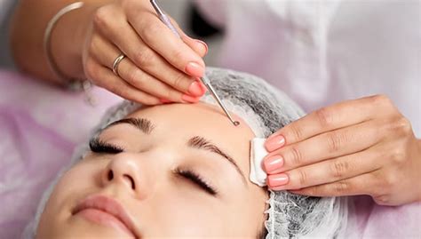 Facial Treatment For Acne In London MALA Aesthetics