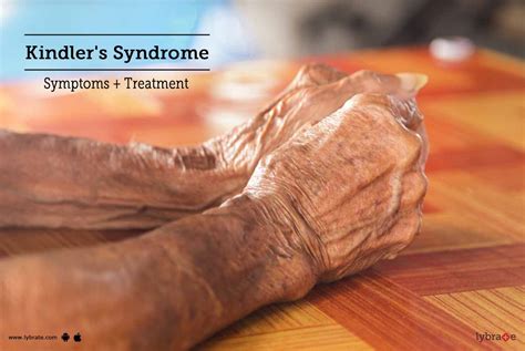Kindler S Syndrome Symptoms Treatment By Dr Ankit M Saxena Lybrate