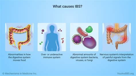 Slide Show Understanding Irritable Bowel Syndrome