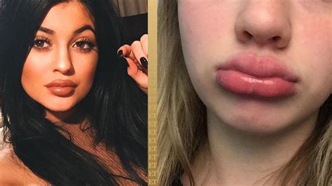Kylie Jenner Responds To People Taking The Disturbing Kylie Jenner