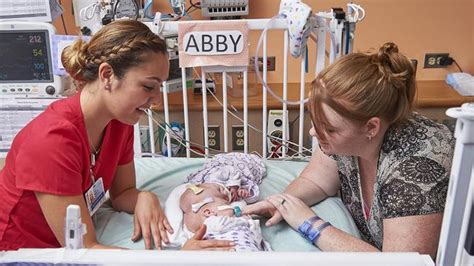 conjoined twins separated successfully at 10 months old herald sun