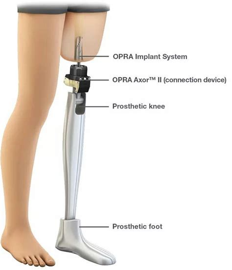 Artifical Leg Prosthetic Leg Orthotics And Prosthetics Leg Prosthesis