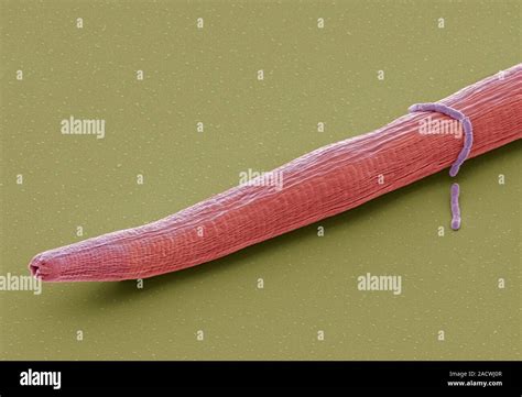 Caenorhabditis Elegans Worm Coloured Scanning Electron Micrograph Sem