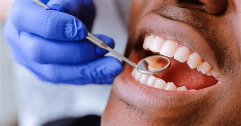 Routine Dental Check Up Best Dental Clinic In Lagos Best Dentist In