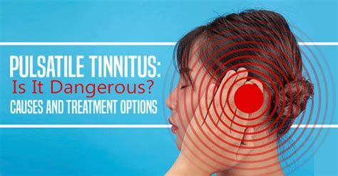 Pulsatile Tinnitus What Is It