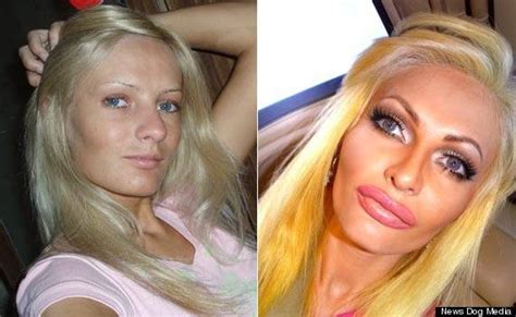 Crazy Plastic Surgery Before And After