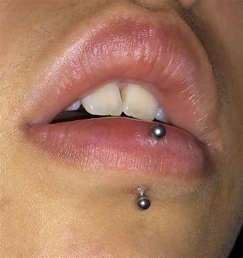 had my vertical labret pierced 5 weeks ago it s formed a small red bump in the past week no