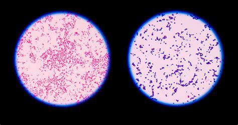 Considering You Can T Identify Bacteria From A Gram Stain Lorelai Has