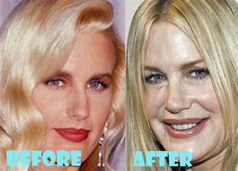 Daryl Hannah Plastic Surgery Before And After Pictures Lovely Surgery