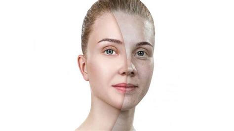 Understanding Sallow Skin Causes Solutions And Complexion Tips Glowing Gorgeous