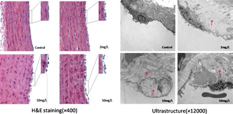 H E Staining And Ultrastructural Changes In The Aortic Arch Endothelium