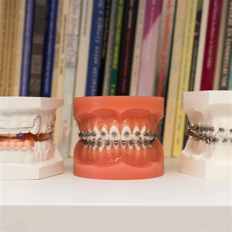 Behandelingen Orthodontiepraktijk Den Helder