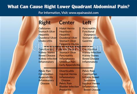 What Can Cause Right Lower Quadrant Abdominal Pain And How